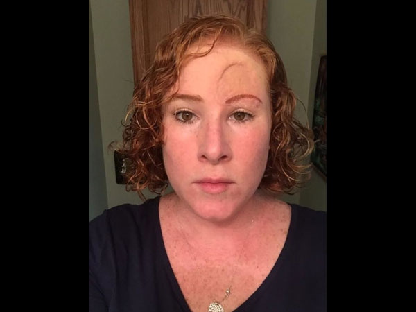 Shocking Images Of Woman Who Got Skin Cancer Shocking Images Of Woman Who Got Skin Cancer