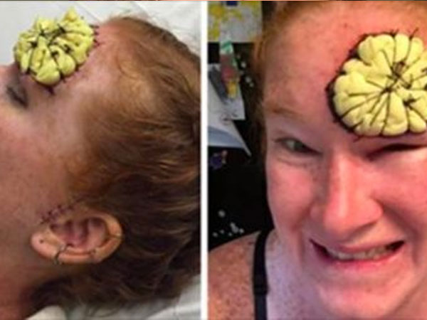 Shocking Images Of Woman Who Got Skin Cancer Shocking Images Of Woman Who Got Skin Cancer