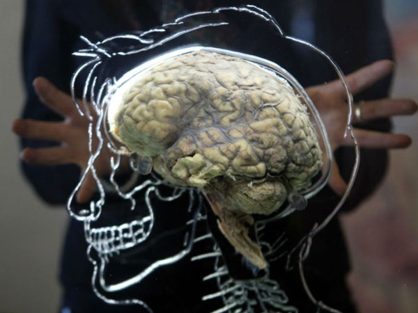 The Effects Of Ageing On The Brain The Effects Of Ageing On The Brain