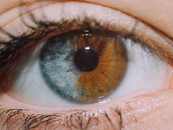 The Eye Colour Is Different!