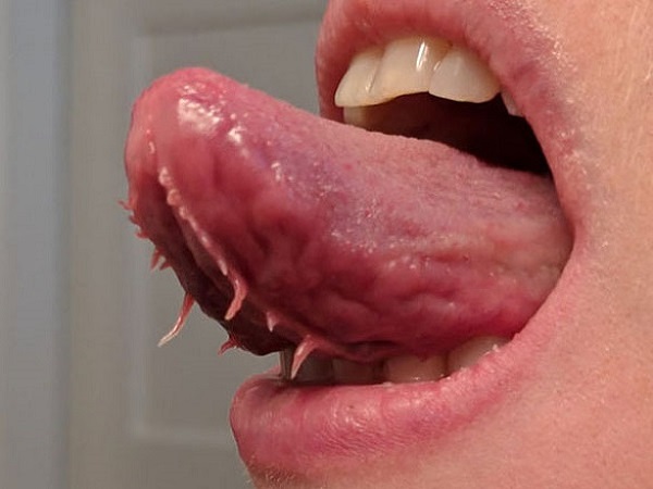 Tentacles On Tongue!