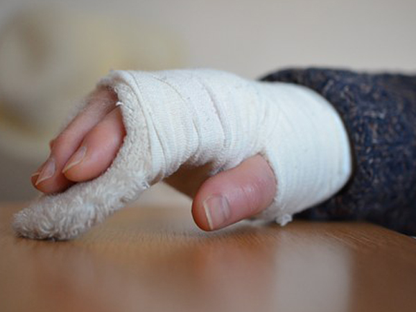 Compartment Syndrome