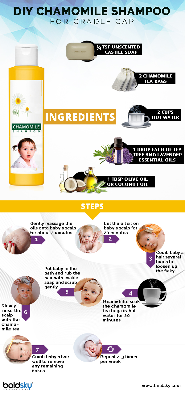 How To Deal With Cradle Cap In Babies