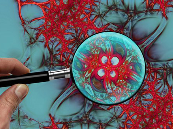 Huntington’s disease