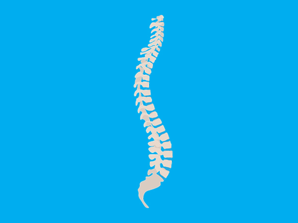 Scoliosis