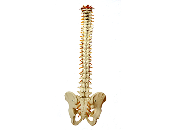 Scoliosis