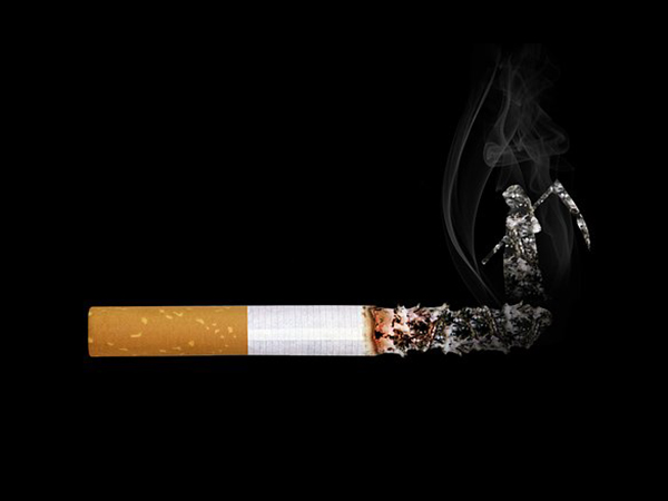 Bronchiectasis Bronchiectasis