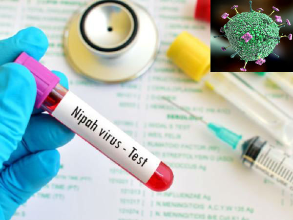 Nipah Virus
