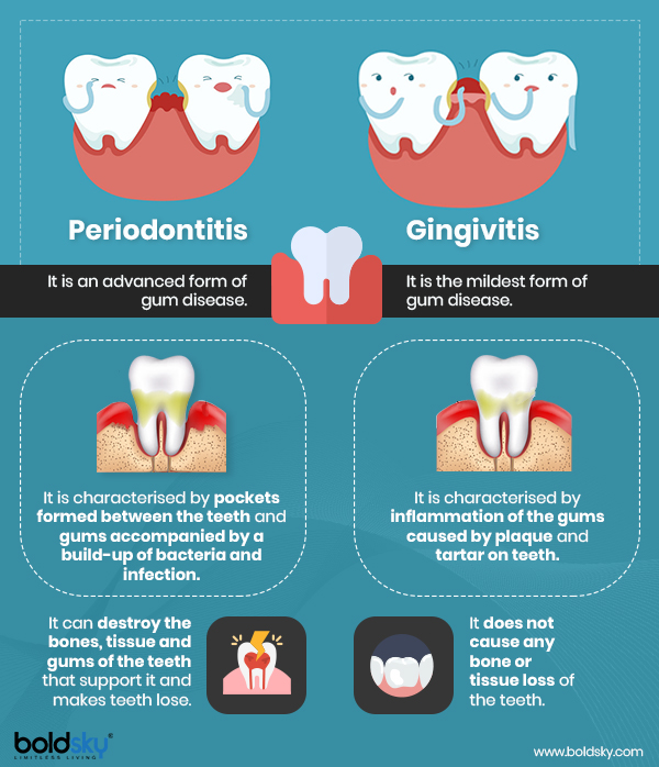 Periodontitis