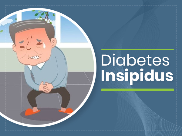 Diabetes Insipidus Diabetes Insipidus