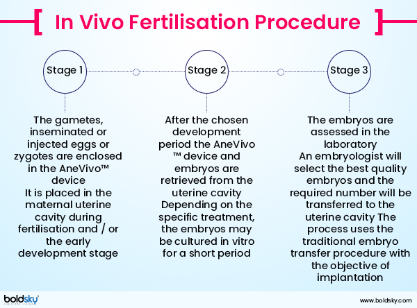IVF