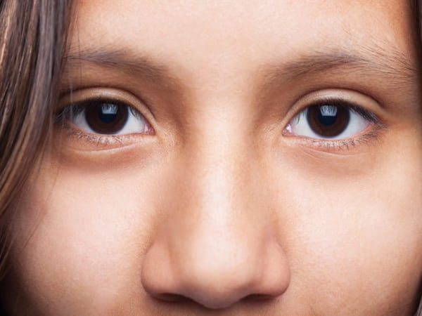 Treatment Of Eyelid Twitches