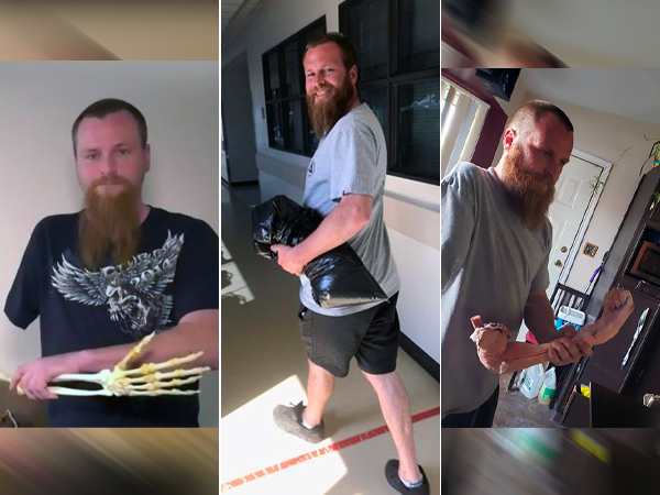 Man Carries His Amputated Arm 