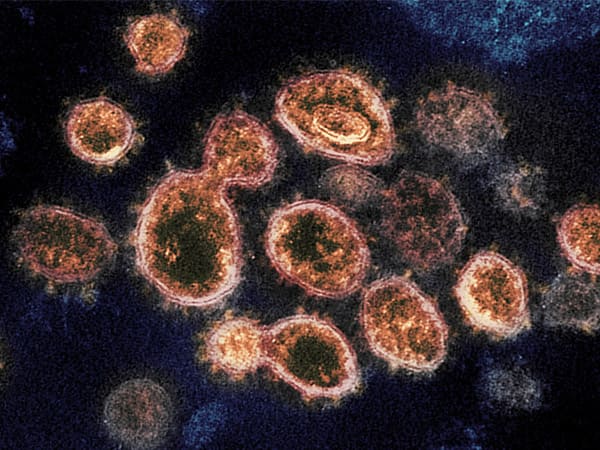coronavirus can live on surface coronavirus can live on surface