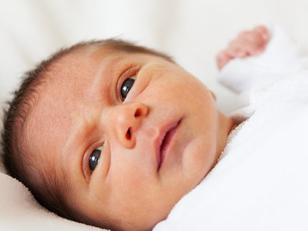 Risk Factors Of Jaundice In Newborns