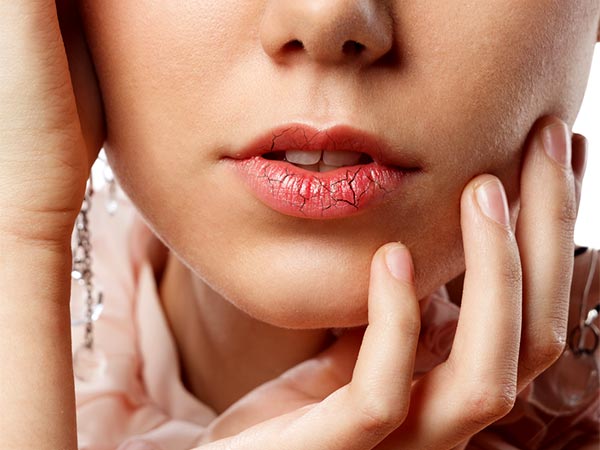 essential oils for chapped lips essential oils for chapped lips