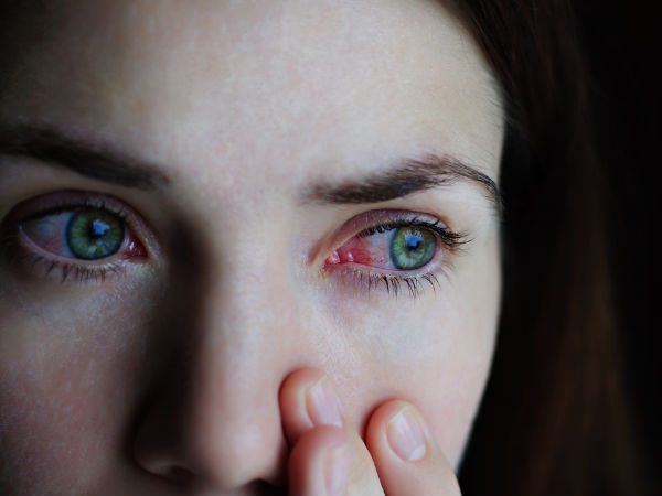 pink eye symptom of coronavirus