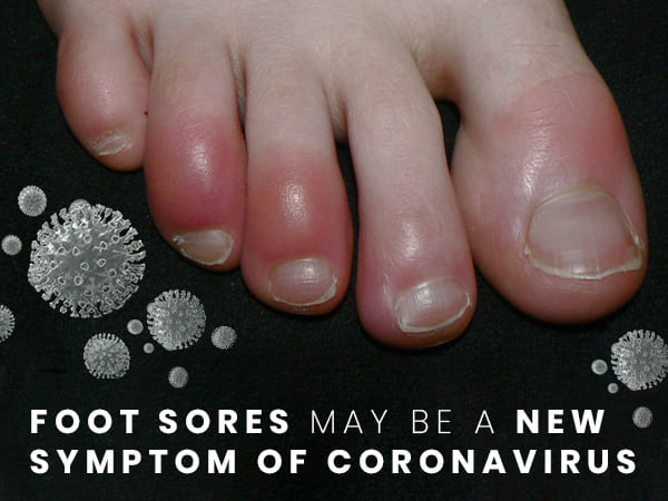foot sores can be early sign of covid-19 foot sores can be early sign of covid-19