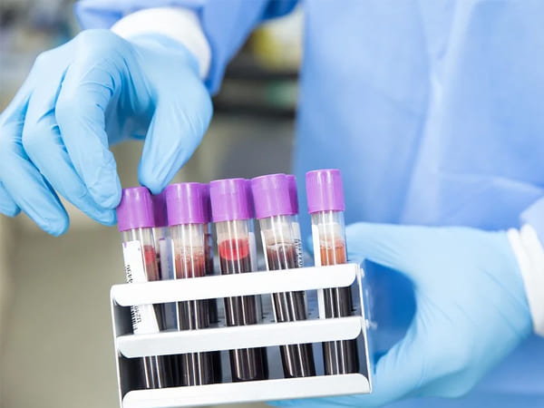 What Is Field-Effect Biosensor?