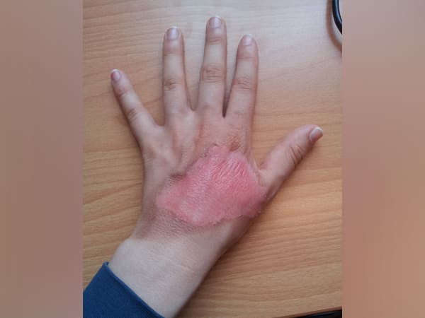 When To Seek Medical Help