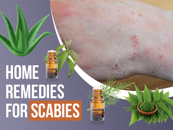 9 Home Remedies That Can Help Treat Scabies Boldsky