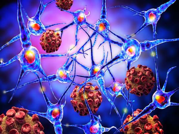 Risk Factors Of Sarcoma