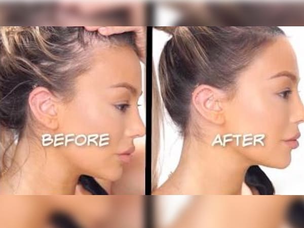 how to fake thicker hairline