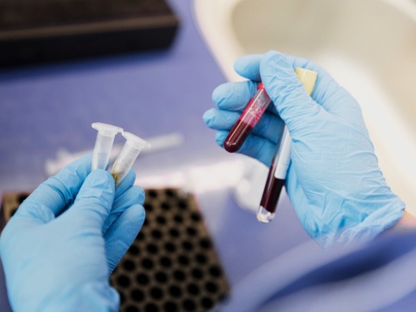 How Is Anaemia Treated?