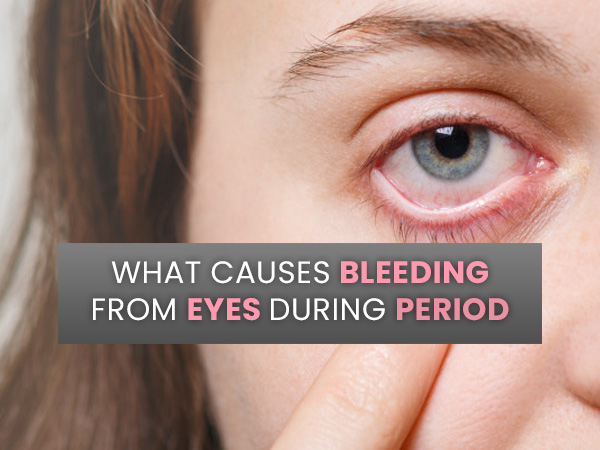 Woman Bleeds From Eyes During Her Period Woman Bleeds From Eyes During Her Period