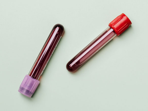 Do’s And Donts For Plasma Donation