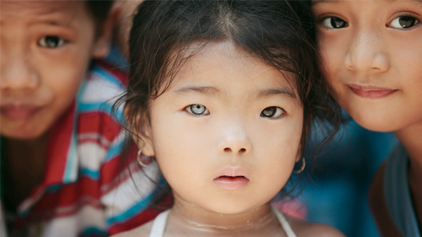 What Is Heterochromia (Different Coloured Eyes) In Humans?