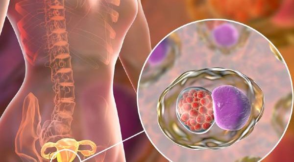 Holistic Management Of Cervical Cancer