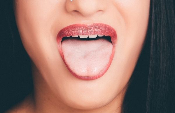 What Is Geographic Tongue