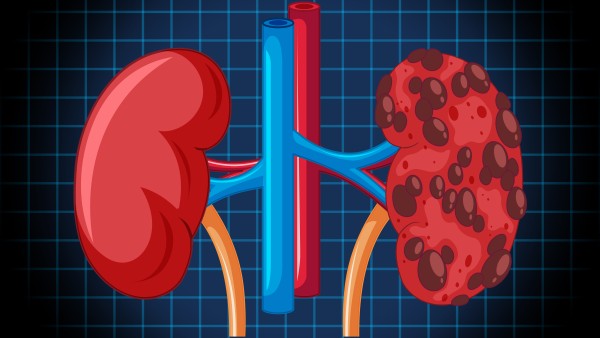 15-Year-Old Undergoes Robotic Surgery