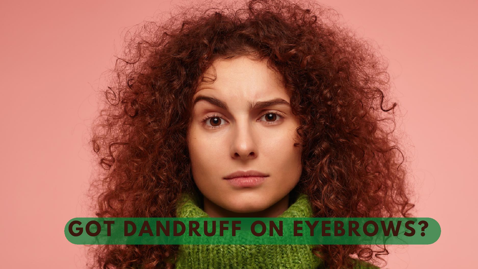 8 Simple Tips To Get Rid Of Eyebrow Dandruff