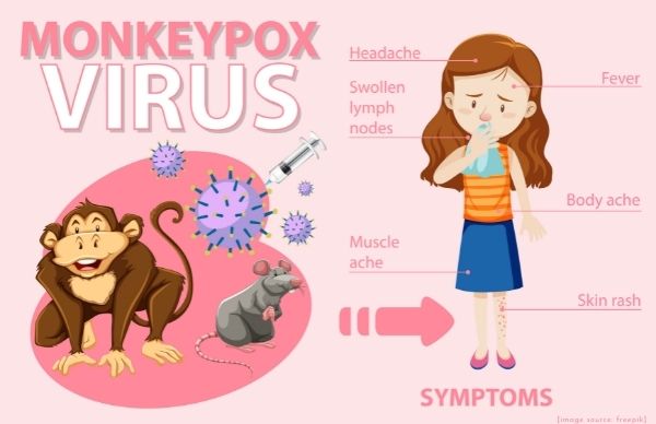 Govt Releases Monkeypox Guidelines