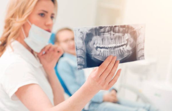 Why Is Wisdom Tooth Removal So Common?