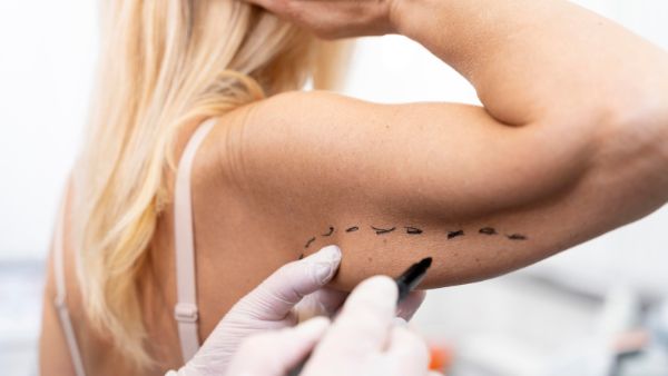 National Plastic Surgery Day 2022