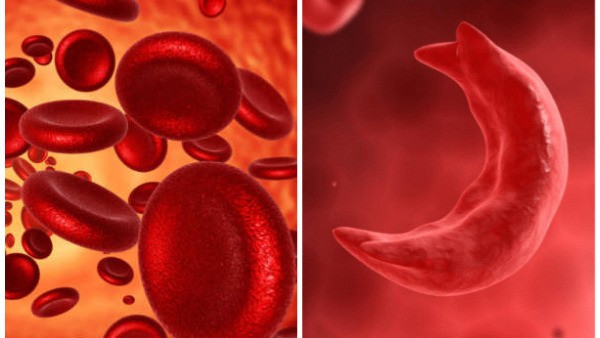 Preventive Steps For Genetic Diseases