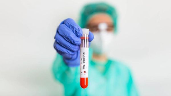 Monkeypox Vs Chickenpox: Know The Differences; Are Kids At Risk?