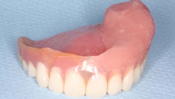 Obturators In Dentistry