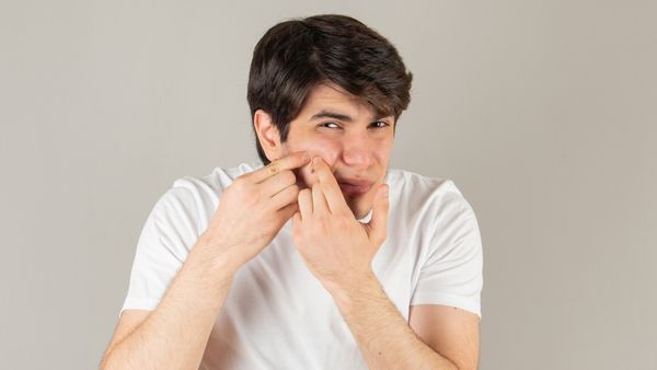 Five Tips To Manage A Popped Pimple
