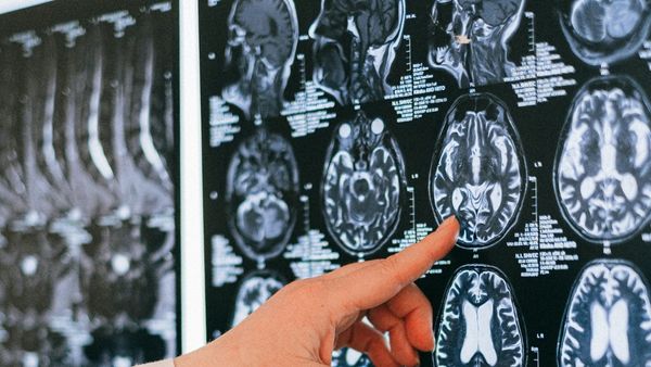 ritney Spears Reveals She Suffered Irreversible Nerve Damage