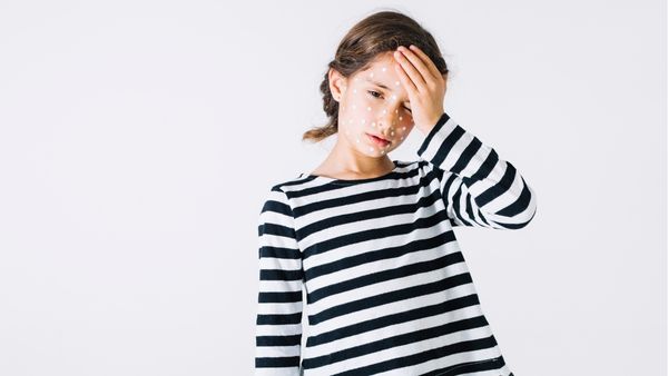 Measles Prevention Through Mumbai Authorities Dharavi Model: Details 