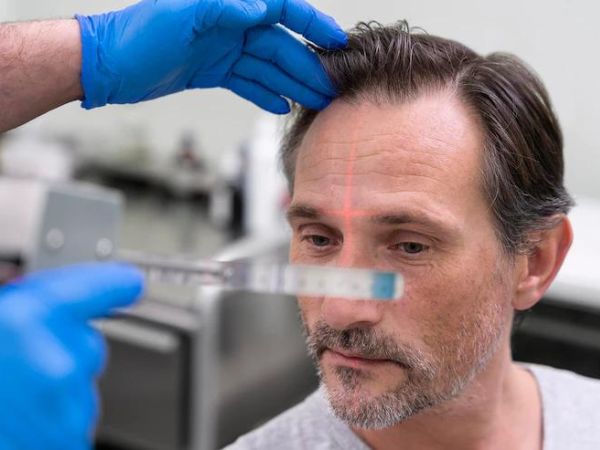 Supplements For Hair Loss