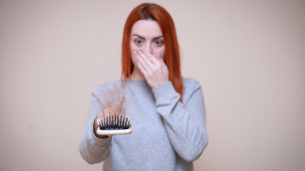 How Much Hair Loss Is Normal How Much Hair Loss Is Normal