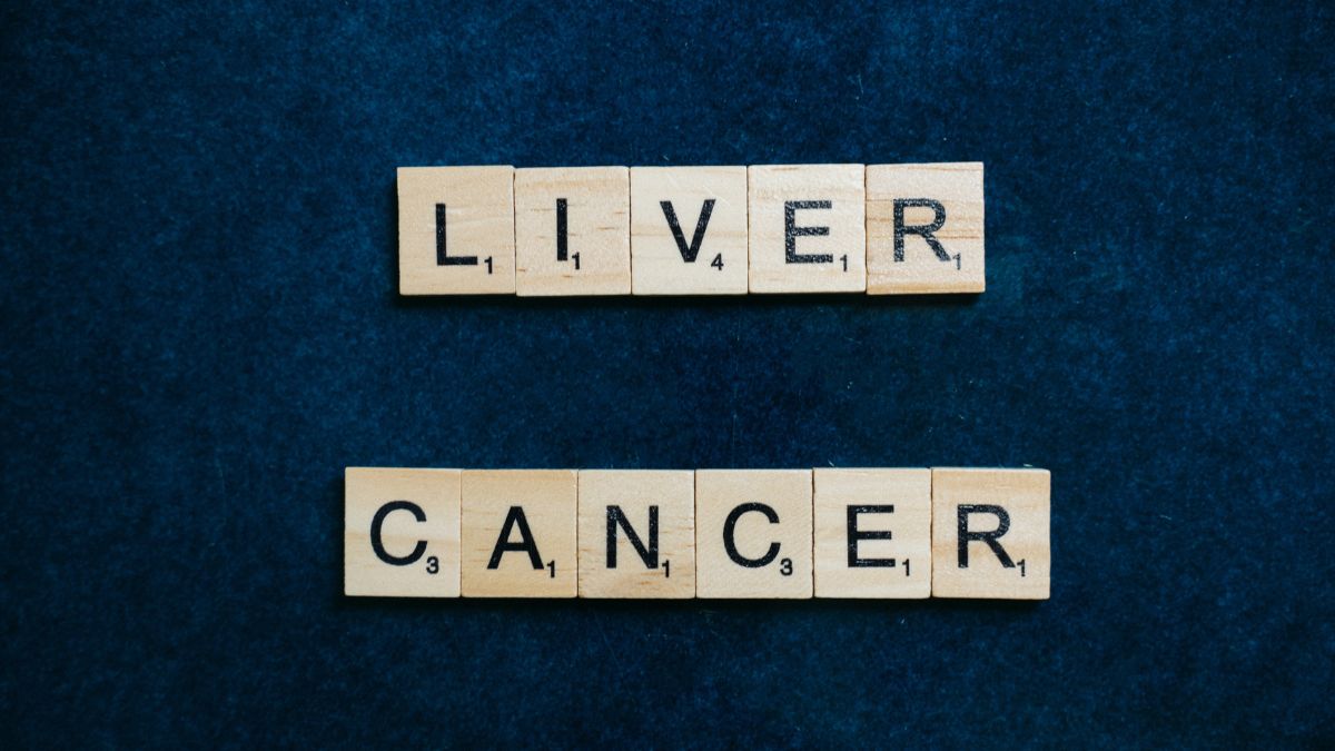 How To Prevent Liver Cancer How To Prevent Liver Cancer