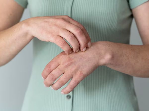 What Causes Itchy Palms