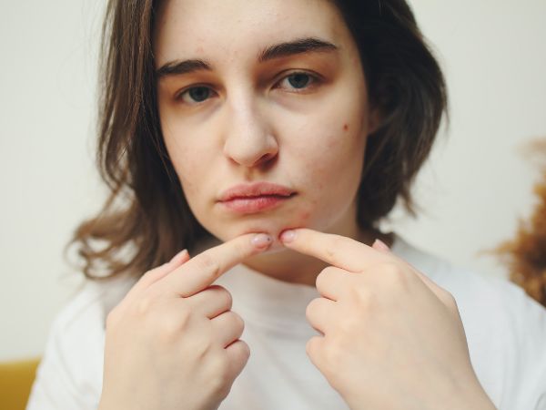 Habits That Are Making Your Acne Worse