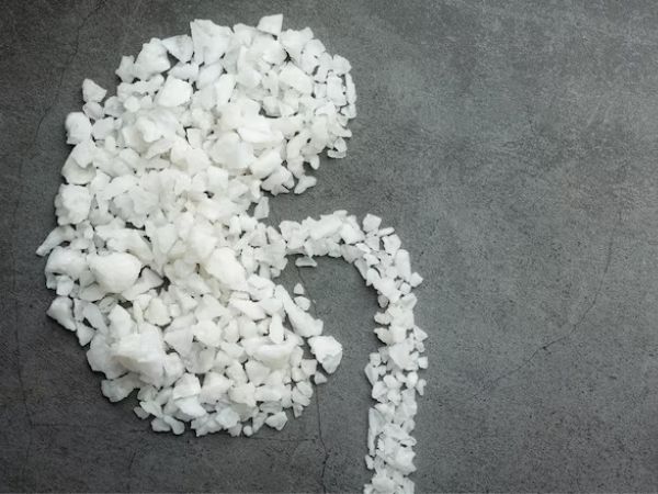 Kidney Stones In Children